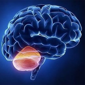Thoái hóa tế bào thần kinh